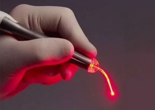 Learn about Laser Surgery for Piles, Fissure, Fistula and Pilonidal Sinus